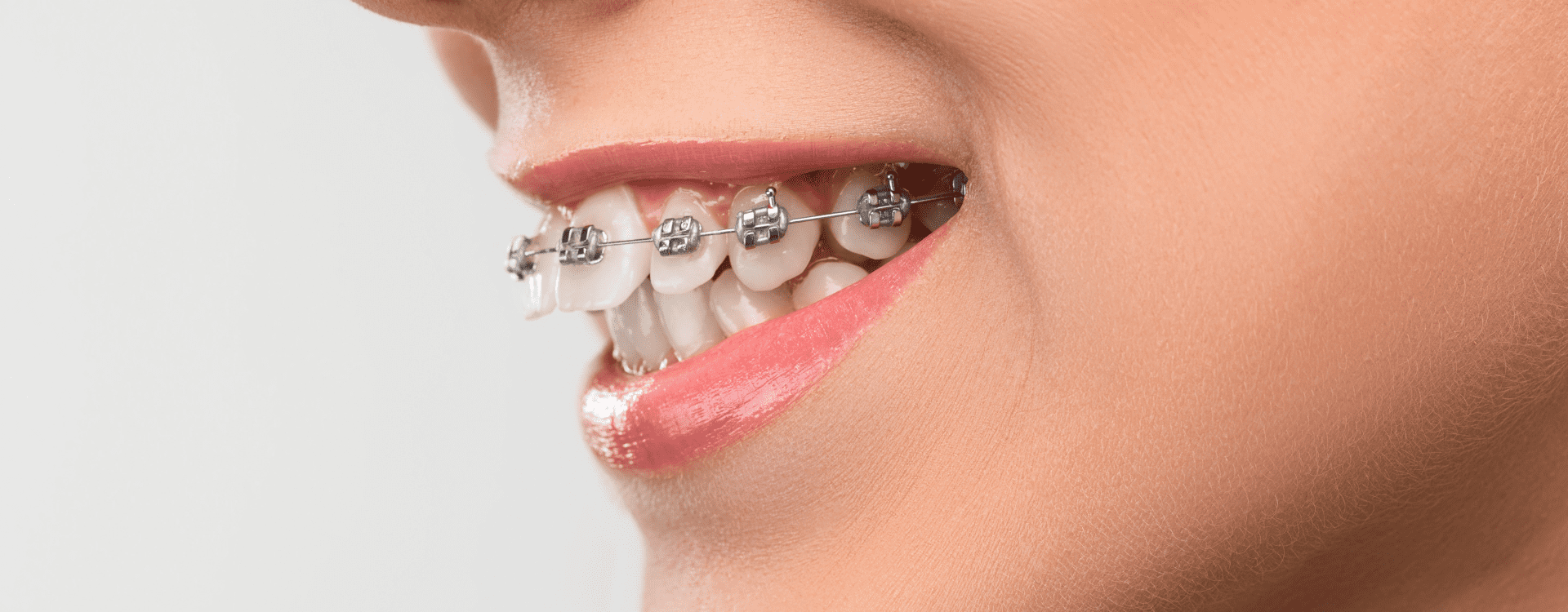 The Braces Centre & Complete Dental Care